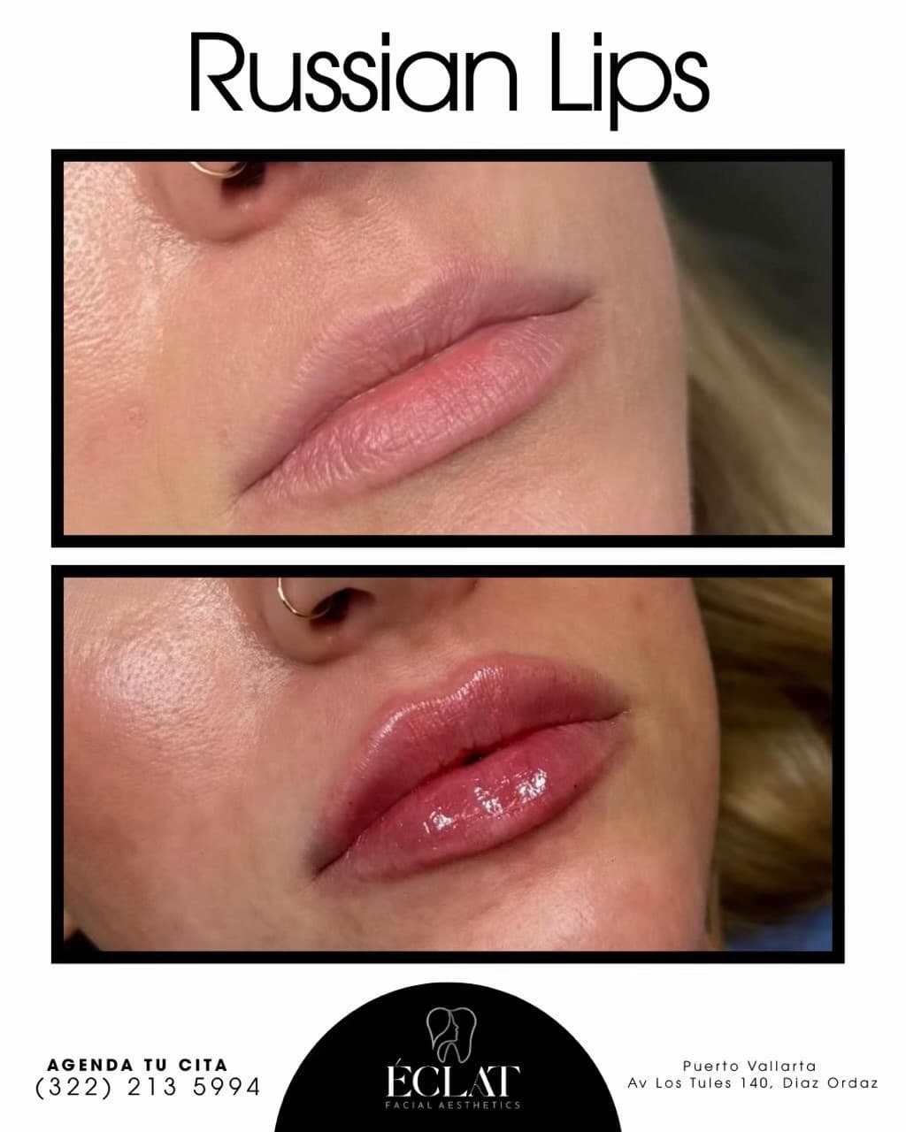 Eclat Facial Aesthetics